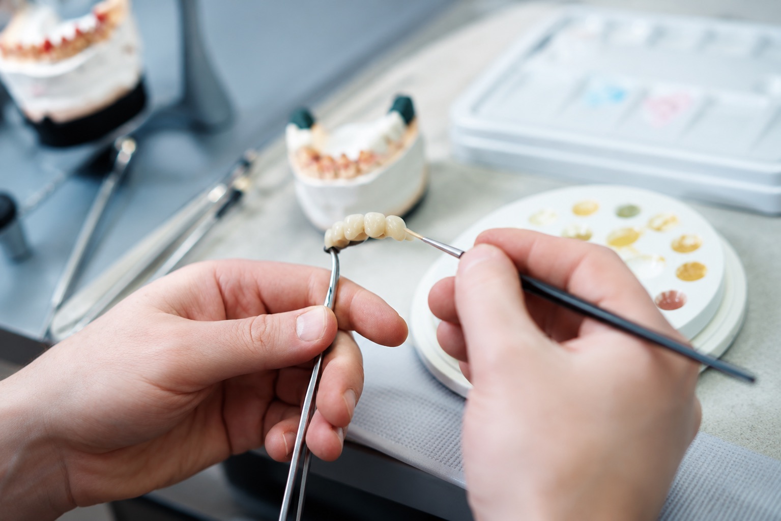 Kronen und Brücken Heberle Dental – Präzise Keramik-Veredelung