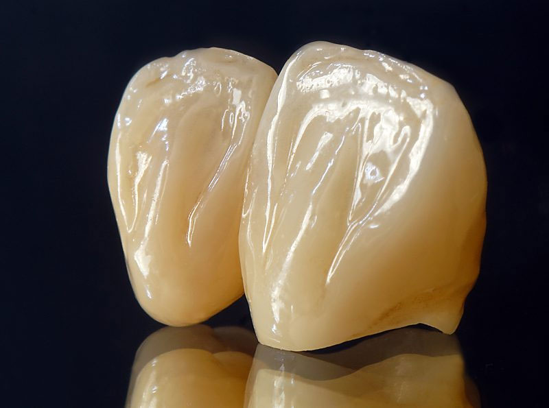 CAD/CAM Frästechnik Heberle Dental – hochpräzise Kronen